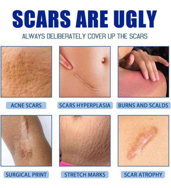 Plastic Scar Removal Cream (White-Blue)