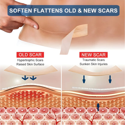 Sand Essential Silicone Scar Tape