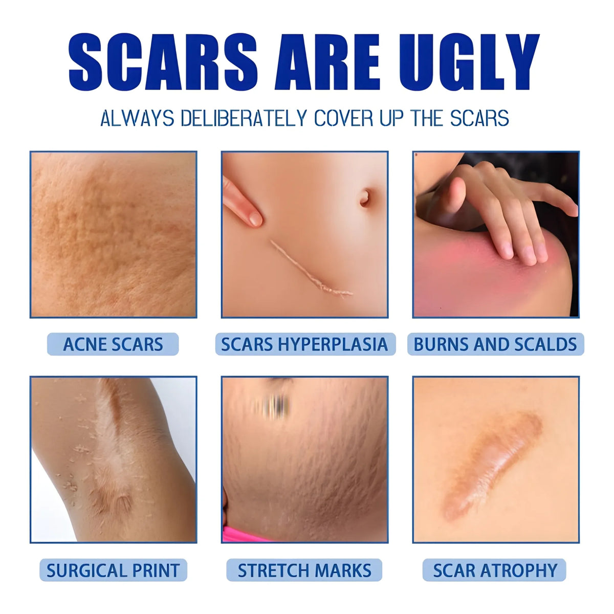 Pearl Essential Plastic Scar Removal