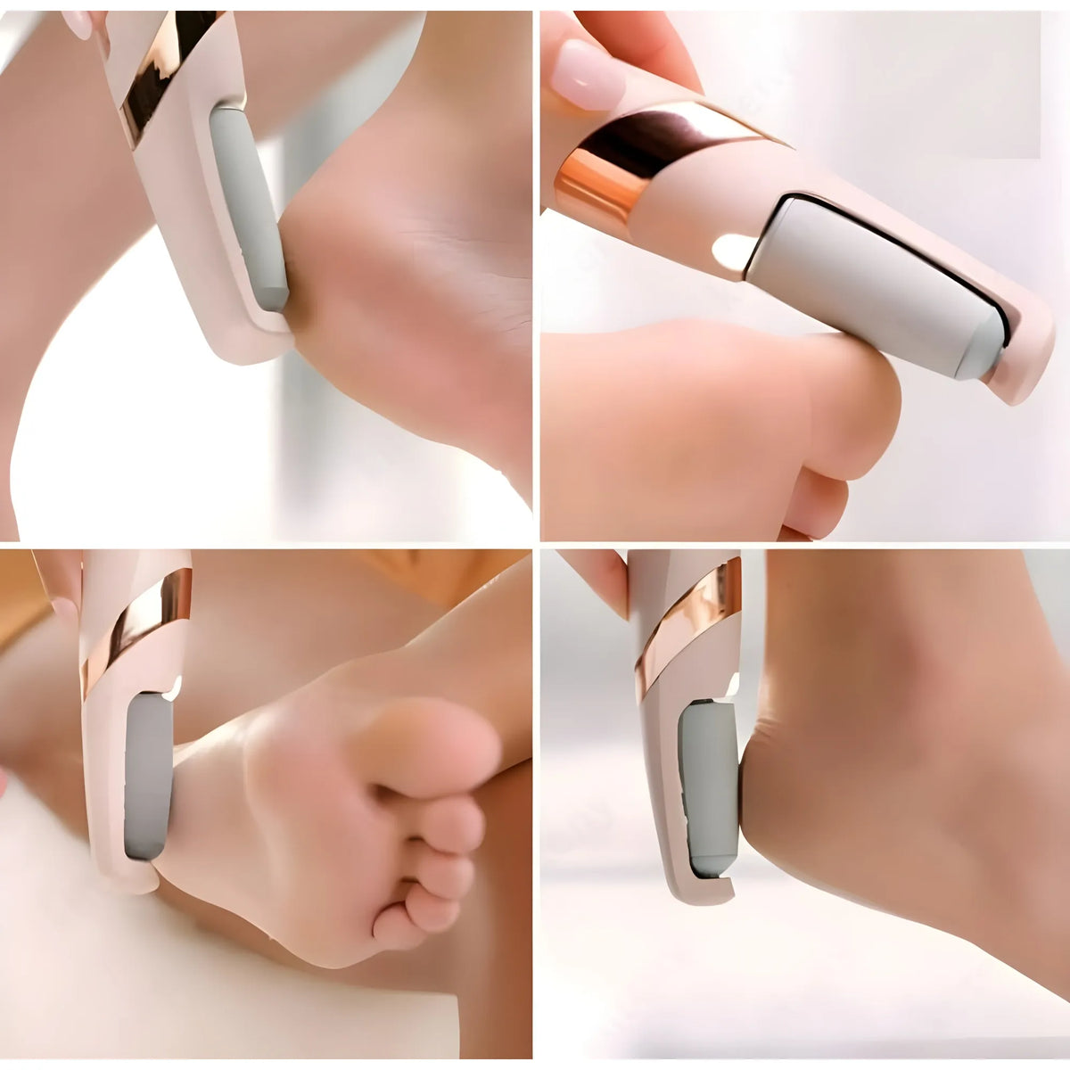 Rose Essential Plastic- Rubber Pedi Roller